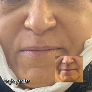 دکتر ‏قدیانی ‏فر ‏خدمات ‏ازون ‏تراپی ‏لایت ‏تراپی ‏پلاسما ‏تراپی ‏در ‏تهران ‏قیطریه 3