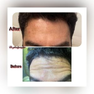 دکتر ‏قدیانی ‏فر ‏خدمات ‏ازون ‏تراپی ‏لایت ‏تراپی ‏پلاسما ‏تراپی ‏در ‏تهران ‏قیطریه 7