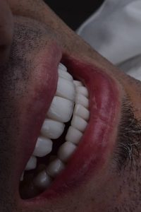 ‏شریف ‏دلربایی ‏کامپوزیت ‏لمینت ‏جراحی ‏فک ‏و ‏صورت ‏‏درمشهد خیام 3