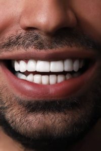 ‏شریف ‏دلربایی ‏کامپوزیت ‏لمینت ‏جراحی ‏فک ‏و ‏صورت ‏‏درمشهد خیام 9