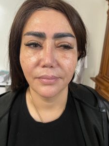 ‏کاشانی ‏لیزر ‏مزوتراپی ‏اندولیفت ‏در ‏تهران پاسداران 3