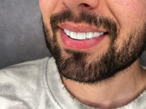 کلینیک ‏اسمایل ‏دنتال ‏خدمات ‏جرم ‏گیری ‏پالیش ‏دندان ‏تخصصی ‏در ‏تهران ‏تهرانپارس