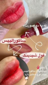 راحله فخیم میکروبلیدینگ خط چشم دائم بن مژه در باهنر مشهد 9