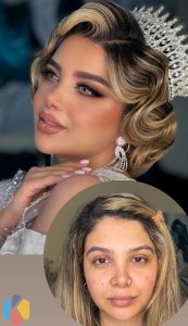 سارا خاکی فیروز خدمات رنگ لایت پروتئین در کرج شهرک وحدت 5