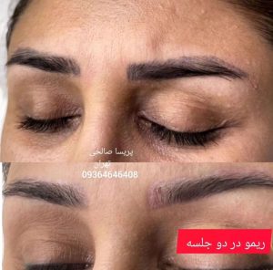 سالن زیبایی و میکرو پریسا صالحی فیبروز میکرو لب و چشم ابرو ریمو ابرو در فلاح 15