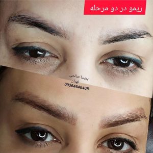 سالن زیبایی و میکرو پریسا صالحی فیبروز میکرو لب و چشم ابرو ریمو ابرو در فلاح 16
