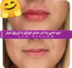 ‏زیبایی ‏پوست ‏و ‏مو ‏ژیلاوش ‏لابیا ‏پلاستی ‏فیلر ‏بادی ‏سینه ‏لیزر ‏موهای ‏زائد ‏در ‏تهرانسر 2