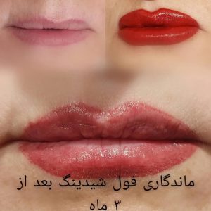 مرکز ‏لاغری ‏نیو ‏استایل ‏خدمات ‏‏پلاژن ‏تراپی ‏و هیدرودرمی ‏و ‏کربوکسی ‏تراپی ‏در ‏کارگر ‏جنوبی 7 result