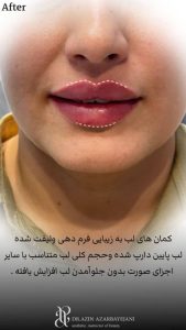 dr azin 5