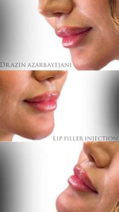 dr azin 8