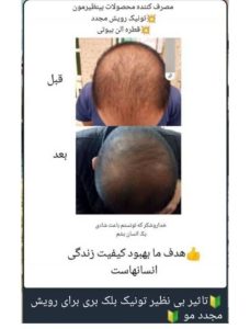 آنلاین ‏شاپ ‏بهار ‏بیوتی ‏جوانساز ‏صورت ‏کرم ‏های ‏مراقبتی ‏ماسک ‏مو ‏در ‏باغستان ‏کرج 17