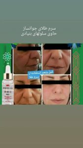 آنلاین ‏شاپ ‏بهار ‏بیوتی ‏جوانساز ‏صورت ‏کرم ‏های ‏مراقبتی ‏ماسک ‏مو ‏در ‏باغستان ‏کرج 19