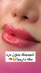 الناز جعفری میکروپیگمنتیشن ریمو ابرو بن مژه در جهانشهر عظیمیه 5