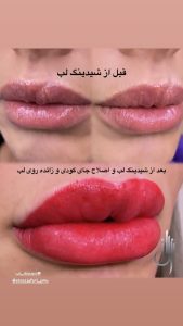 الناز ‏جعفری ‏میکروبلیدینگ ‏شیدینگ ‏لب ‏خط ‏چشم ‏در ‏گلشهر ‏گوهردشت 7
