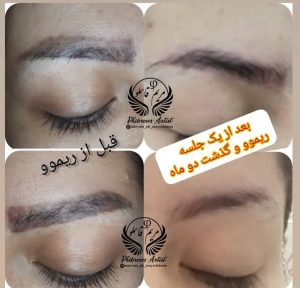 سالن رویسا خدمات ریموو تاتو ابرو فیبروز خط چشم بن مژه در هفده شهریور تهران 10