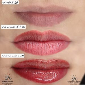 سالن رویسا خدمات ریموو تاتو ابرو فیبروز خط چشم بن مژه در هفده شهریور تهران 7