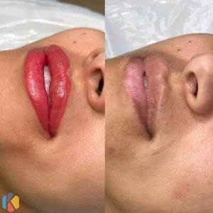 زیبایی تیکال رنگ لایت میکاپ شینیون عروس در قرچک ورامین 2 result