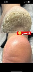 سالن زیبایی عسل داستان و کاشت ناخن پدیکور و مانیکور در میدان هفت تیر مشهد 3