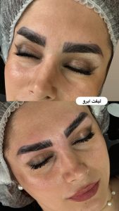 سالن زیبایی مرکاتو فیشال پاکسازی پوست اسیدتراپی در شمس آباد هروی 17