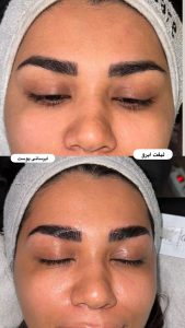 سالن زیبایی مرکاتو فیشال پاکسازی پوست اسیدتراپی در شمس آباد هروی 18