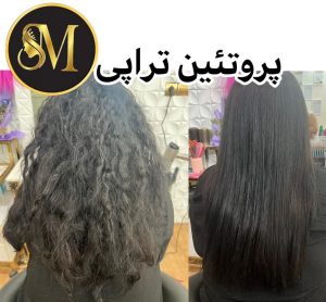 سالن زیبایی مهر مزونیدلینگ ژل لب تزریق بوتاکس در هفت تیر قم 11