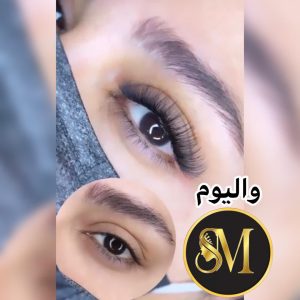 سالن زیبایی مهر مزونیدلینگ ژل لب تزریق بوتاکس در هفت تیر قم 13