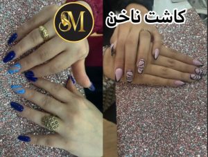 سالن زیبایی مهر مزونیدلینگ ژل لب تزریق بوتاکس در هفت تیر قم 14
