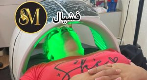 سالن زیبایی مهر مزونیدلینگ ژل لب تزریق بوتاکس در هفت تیر قم 2