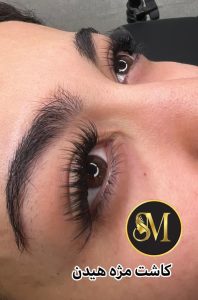 سالن زیبایی مهر مزونیدلینگ ژل لب تزریق بوتاکس در هفت تیر قم 4