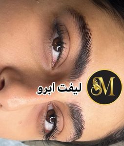 سالن زیبایی مهر مزونیدلینگ ژل لب تزریق بوتاکس در هفت تیر قم 5