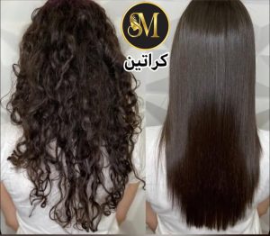 سالن زیبایی مهر مزونیدلینگ ژل لب تزریق بوتاکس در هفت تیر قم 7
