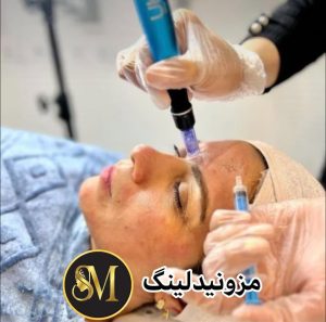 سالن زیبایی مهر مزونیدلینگ ژل لب تزریق بوتاکس در هفت تیر قم 9