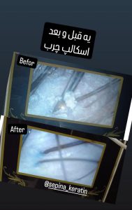 سالن زیبایی هانیه خدمات احیا و صافی و کراتین مو در فلکه سوم تهرانپارس 4