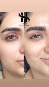 سالن شقایق رسا میکروبلیدینگ ابرو سوپر نچرال و نچرال بروز در کرج گوهردشت 19