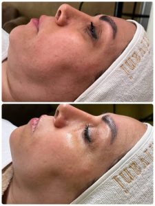 سالن ‏زیبایی ‏عاطفه ‏مریوانی ‏مرکز ‏فیشال ‏تخصصی ‏پوست ‏در ‏اسلامشهر ‏واوان 13
