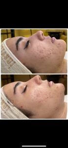 سالن ‏زیبایی ‏عاطفه ‏مریوانی ‏مرکز ‏فیشال ‏تخصصی ‏پوست ‏در ‏اسلامشهر ‏واوان