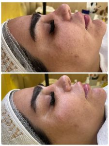 سالن ‏زیبایی ‏عاطفه ‏مریوانی ‏مرکز ‏فیشال ‏تخصصی ‏پوست ‏در ‏اسلامشهر ‏واوان 14
