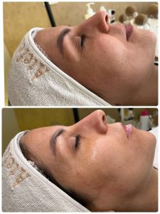 سالن ‏زیبایی ‏عاطفه ‏مریوانی ‏مرکز ‏فیشال ‏تخصصی ‏پوست ‏در ‏اسلامشهر ‏واوان 16