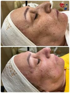 سالن ‏زیبایی ‏عاطفه ‏مریوانی ‏مرکز ‏فیشال ‏تخصصی ‏پوست ‏در ‏اسلامشهر ‏واوان 4