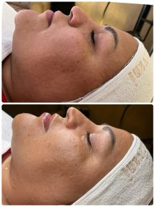 سالن ‏زیبایی ‏عاطفه ‏مریوانی ‏مرکز ‏فیشال ‏تخصصی ‏پوست ‏در ‏اسلامشهر ‏واوان 5
