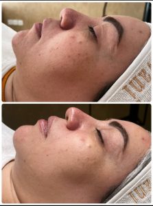 سالن ‏زیبایی ‏عاطفه ‏مریوانی ‏مرکز ‏فیشال ‏تخصصی ‏پوست ‏در ‏اسلامشهر ‏واوان 7