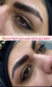 سالن ‏زیبایی ‏فهیمی ‏میکروبلیدینگ ‏تاتو ‏ابرو ‏فیبروز ‏در ‏پیروزی ‏نیروهوایی 16