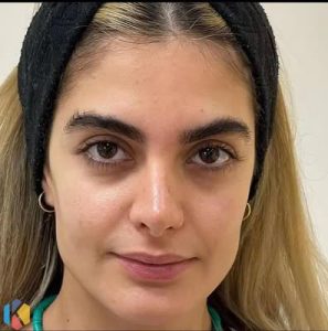 سالن ‏زیبایی ‏نقش ‏بیتا ‏رنگ ‏لایت ‏شینیون ‏کراتین ‏مو ‏در ‏ستارخان ‏غرب ‏تهران 16