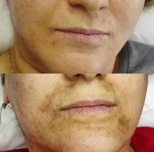 ‏فرناز ‏زمانی ‏خدمات ‏فیشال ‏پاکسازی ‏تخصصی ‏کربوکسی ‏تراپی ‏در ‏مشهد ‏فرامرز ‏عباسی 10