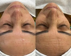 ‏فرناز ‏زمانی ‏خدمات ‏فیشال ‏پاکسازی ‏تخصصی ‏کربوکسی ‏تراپی ‏در ‏مشهد ‏فرامرز ‏عباسی 11