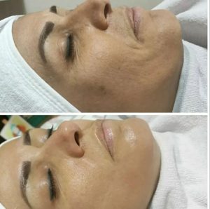 ‏فرناز ‏زمانی ‏خدمات ‏فیشال ‏پاکسازی ‏تخصصی ‏کربوکسی ‏تراپی ‏در ‏مشهد ‏فرامرز ‏عباسی 12