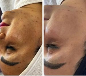 ‏فرناز ‏زمانی ‏خدمات ‏فیشال ‏پاکسازی ‏تخصصی ‏کربوکسی ‏تراپی ‏در ‏مشهد ‏فرامرز ‏عباسی 4