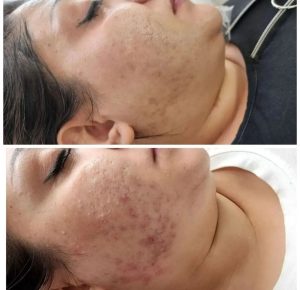 ‏فرناز ‏زمانی ‏خدمات ‏فیشال ‏پاکسازی ‏تخصصی ‏کربوکسی ‏تراپی ‏در ‏مشهد ‏فرامرز ‏عباسی 7