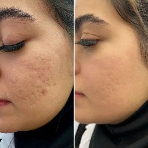 ‏فرناز ‏زمانی ‏خدمات ‏فیشال ‏پاکسازی ‏تخصصی ‏کربوکسی ‏تراپی ‏در ‏مشهد ‏فرامرز ‏عباسی 9