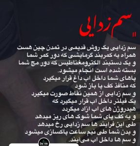 مرکز لیزر و لاغری دلوین خدمات دستگاه لاغری لیزر در تهران ازگل 11